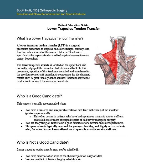 Lower Trapezius Tendon Transfer